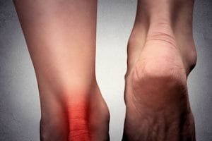 Hardnekkige kniepees- of achillespeesontstekingen: hier enkele trucjes!